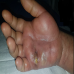 Case Report Image