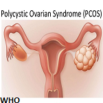 PDF] The Use of Kigelia africana in the Management of Polycystic Ovary  Syndrome (PCOS)